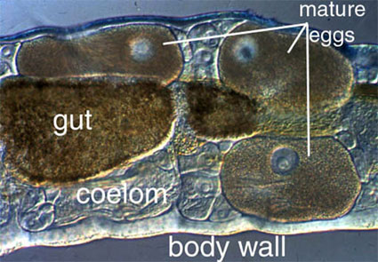 coelom of an annelid